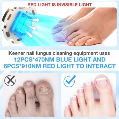 Appareil de soin des ongles des pieds, format voyage – image 2