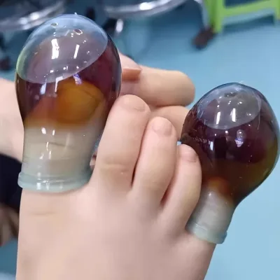 Protège-orteil en silicone souple réutilisable